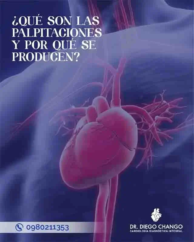 ¿Qué son las palpitaciones?