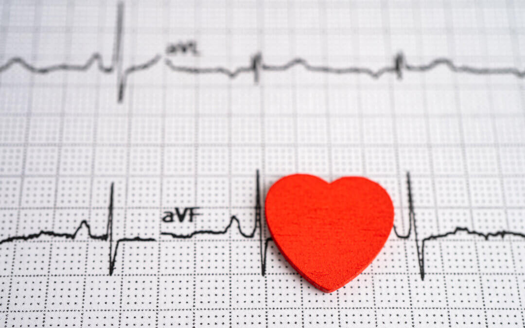 Electrocardiograma y salud cardíaca: qué detecta un ECG